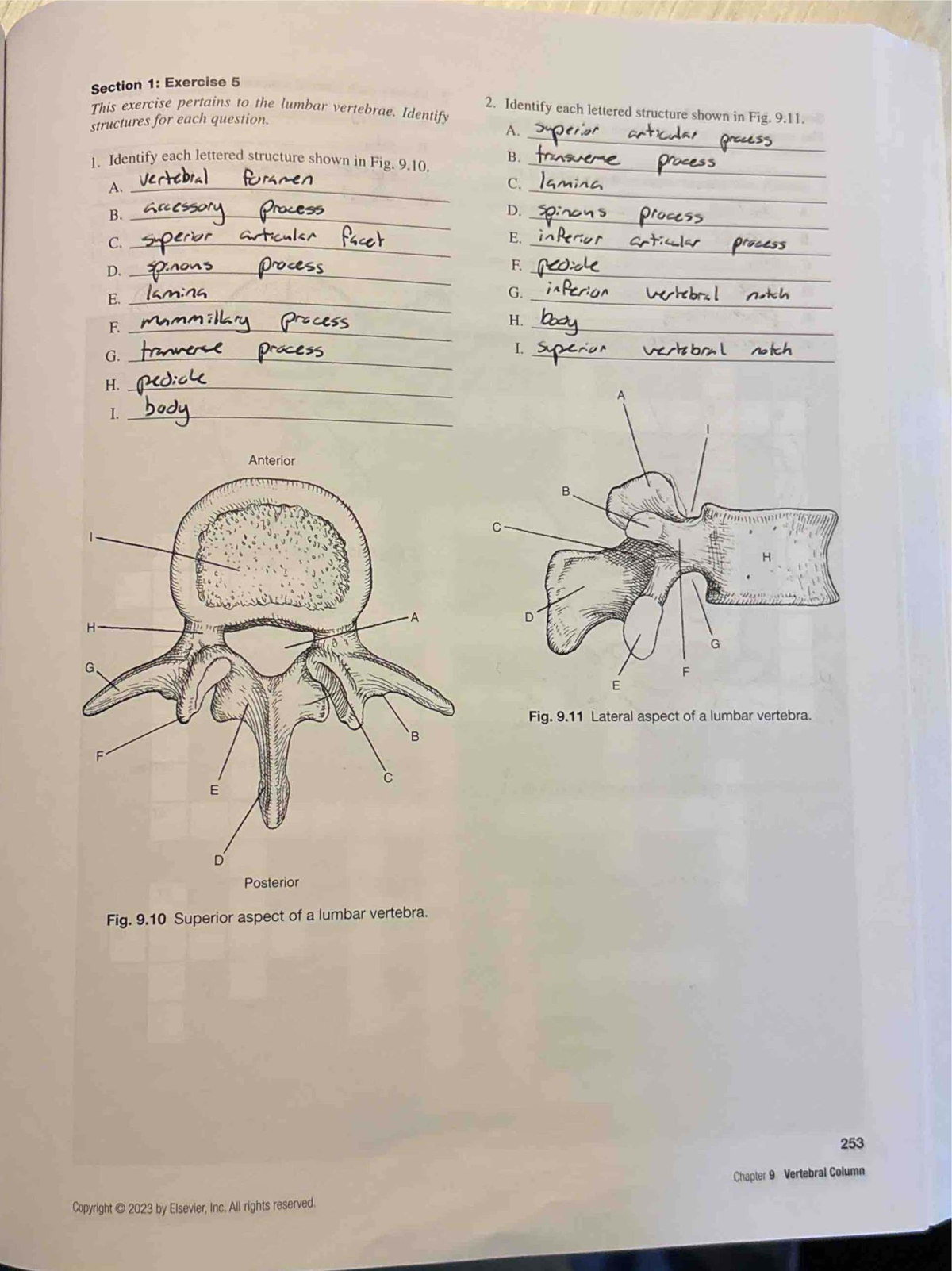 Spine Part 2 Workbook: Lumbar and Sacral Vertebrae Exercises - Studocu