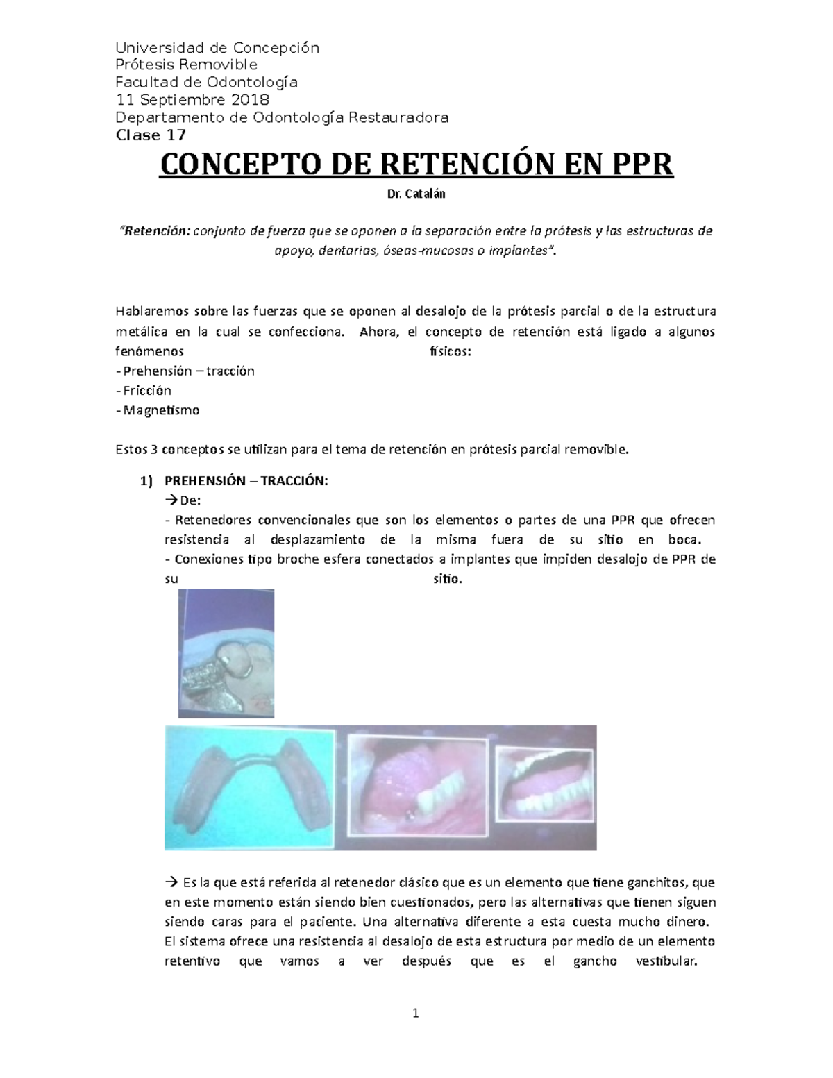 Clase 17: Retención en Prótesis Parcial Removible (PPR) - Studocu