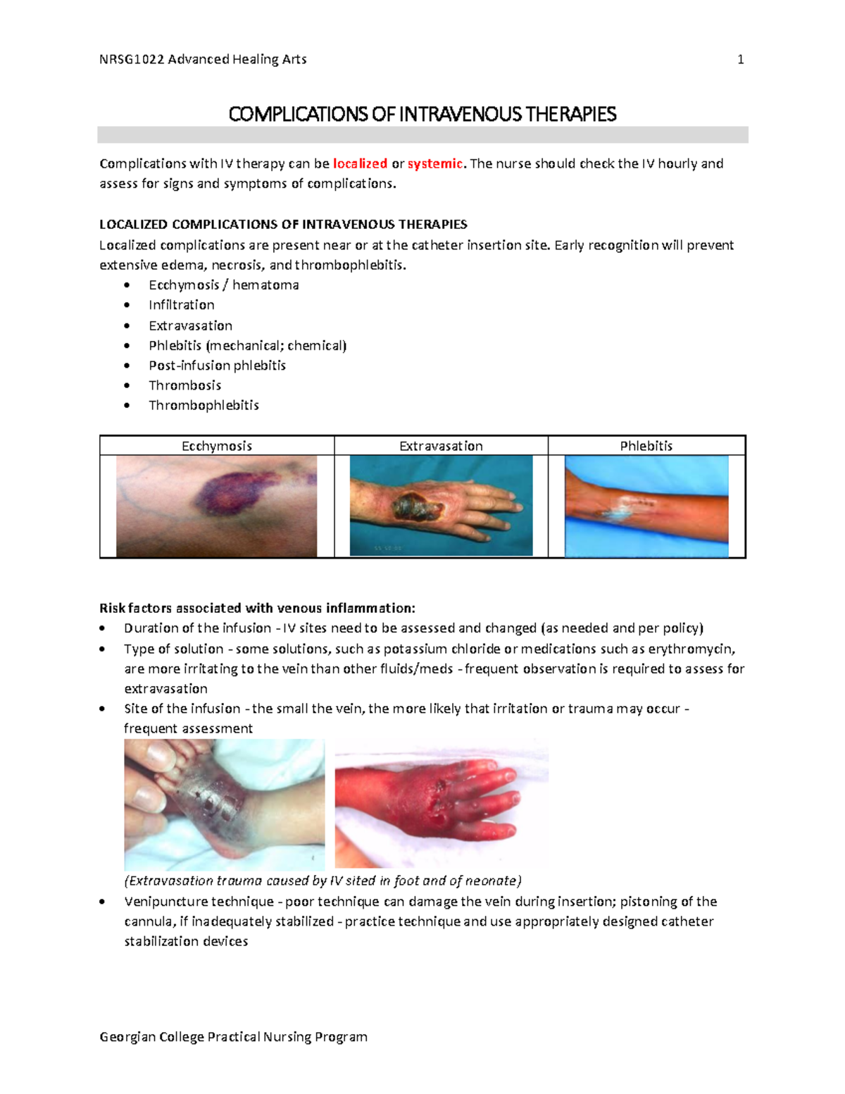 Iv Infiltration Signs And Symptoms