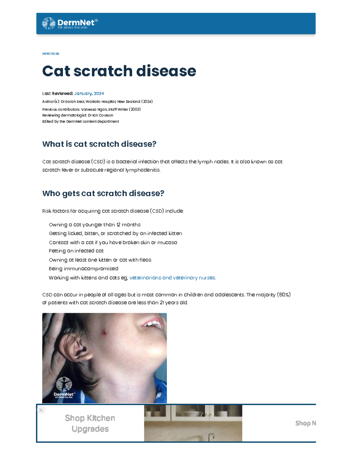 Cat Scratch Disease Guidelines