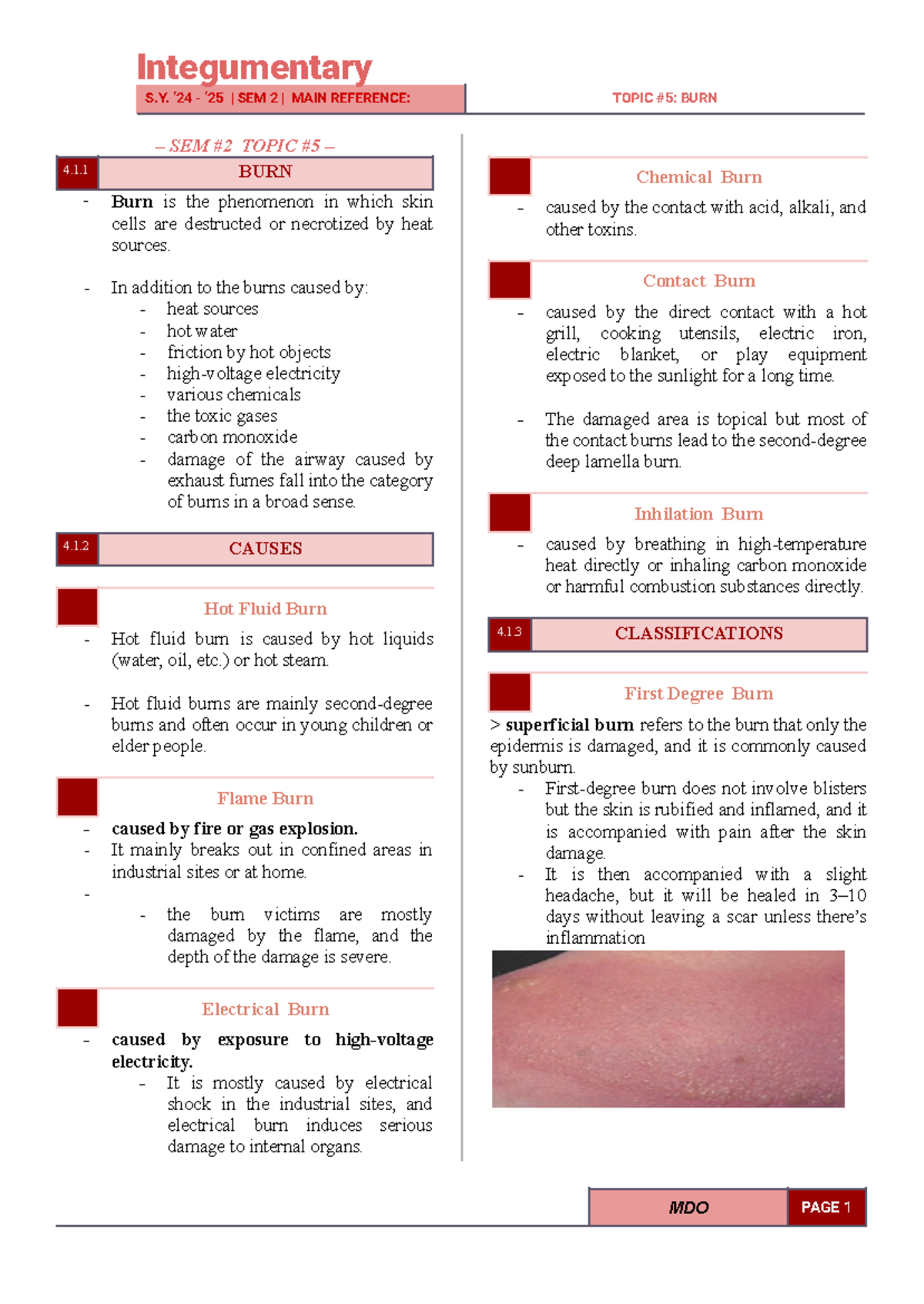 BURN - reviewer for burn - S. ‘24 - ‘25 | SEM 2 | MAIN REFERENCE: TOPIC ...