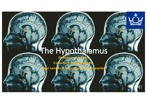 Understanding the Hypothalamus: Anatomy, Functions, and Disorders ...