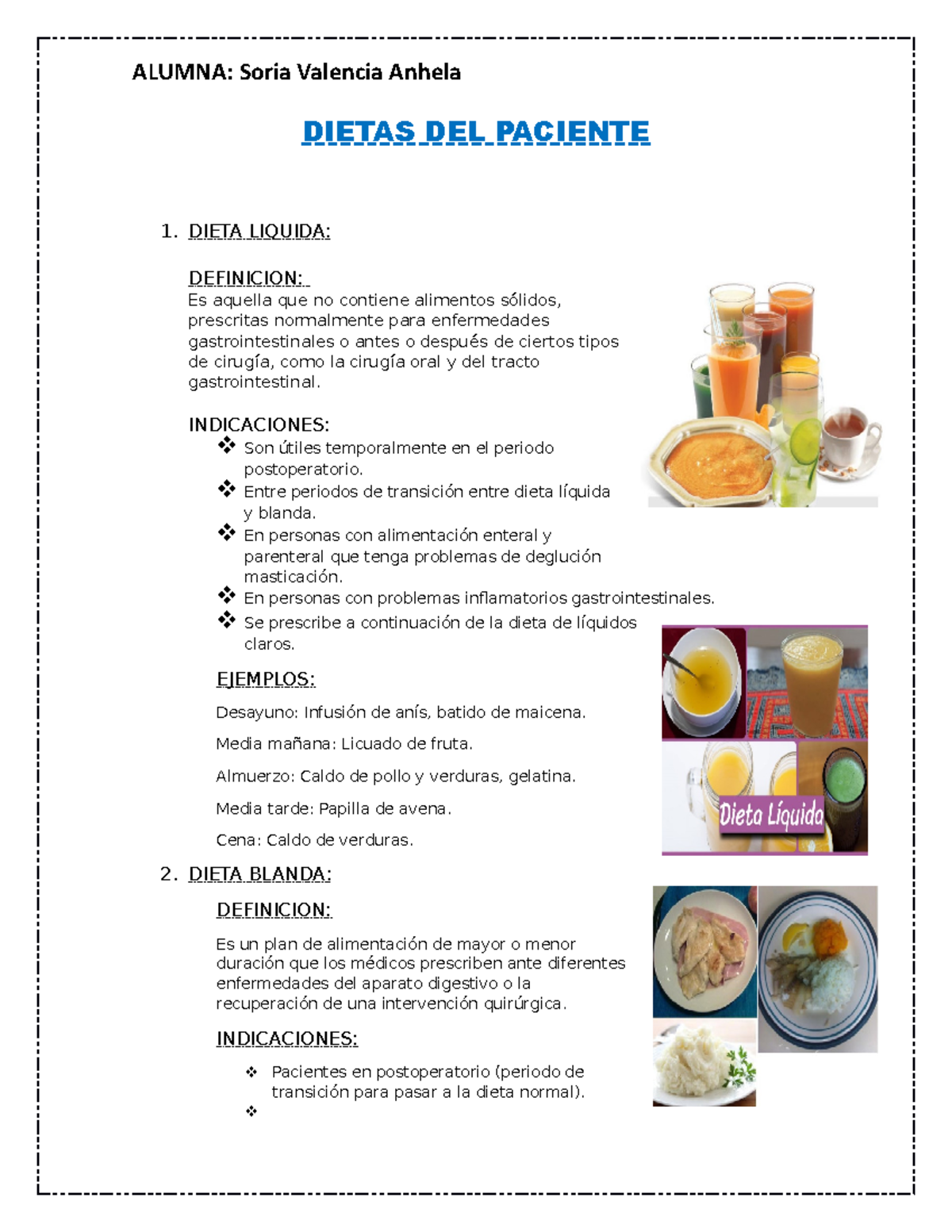 Dietas DEL Paciente 2021 - ALUMNA: Soria Valencia Anhela DIETAS DEL