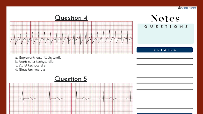 Archer Review: Cardiac Rhythm Questions & Answers - Studocu