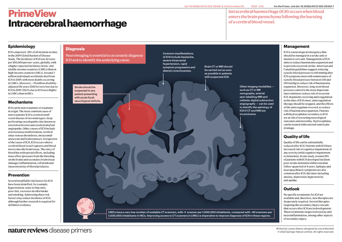 Epidemiology and Management of Intracerebral Haemorrhage (ICH ...