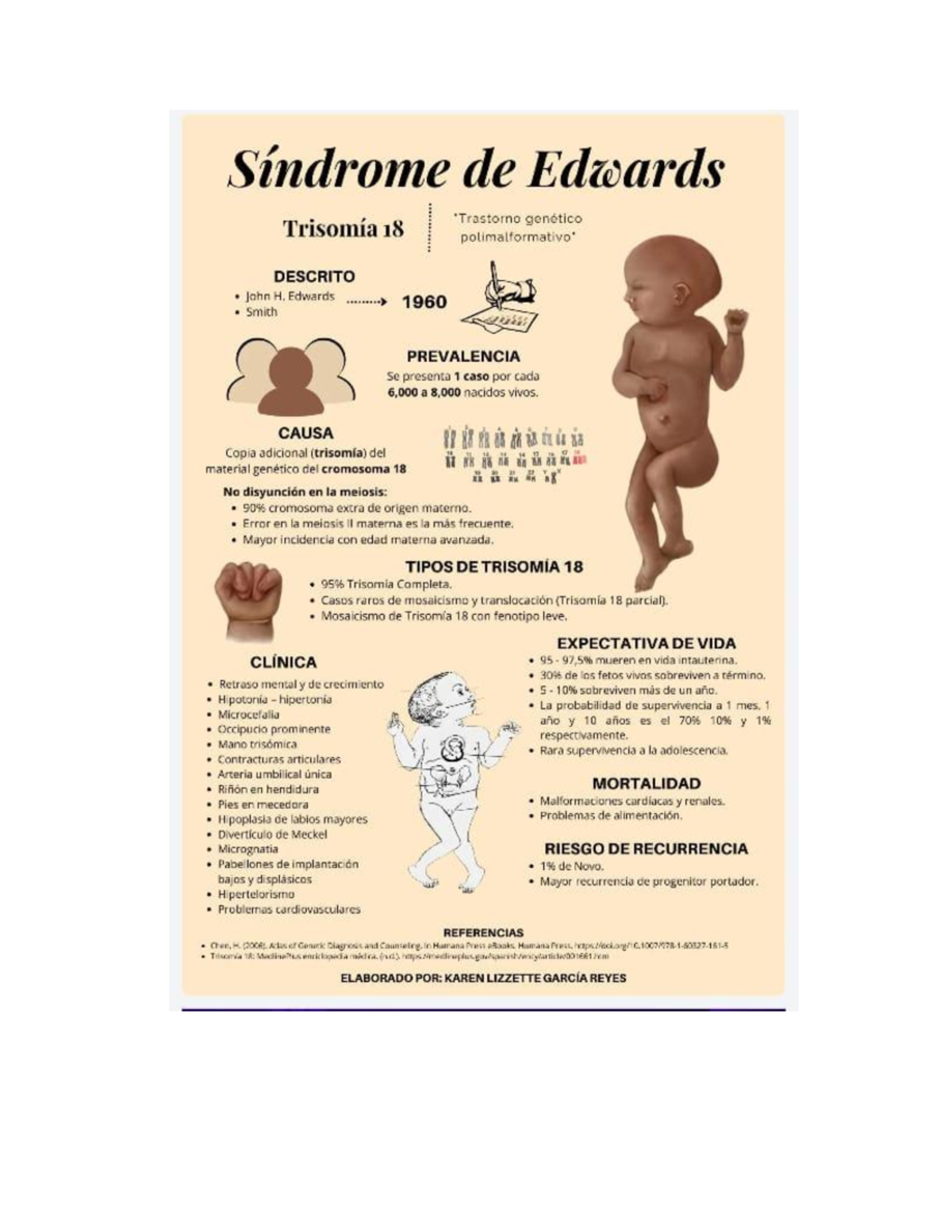 Apuntes sobre el Síndrome de Edwards (Trisomía 18) - Cl. Lenguaje - Studocu