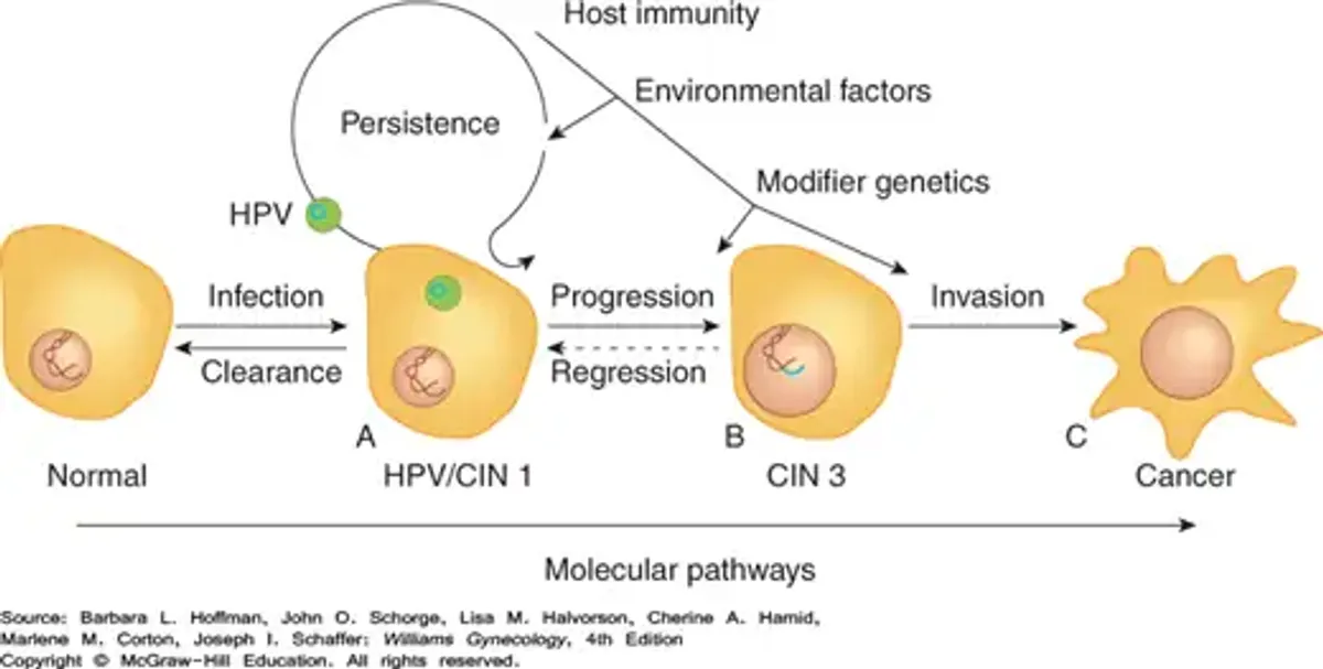 Cáncer de Cuello Uterino - Capítulo 30 de Ginecología Williams, 4e - Document Preview