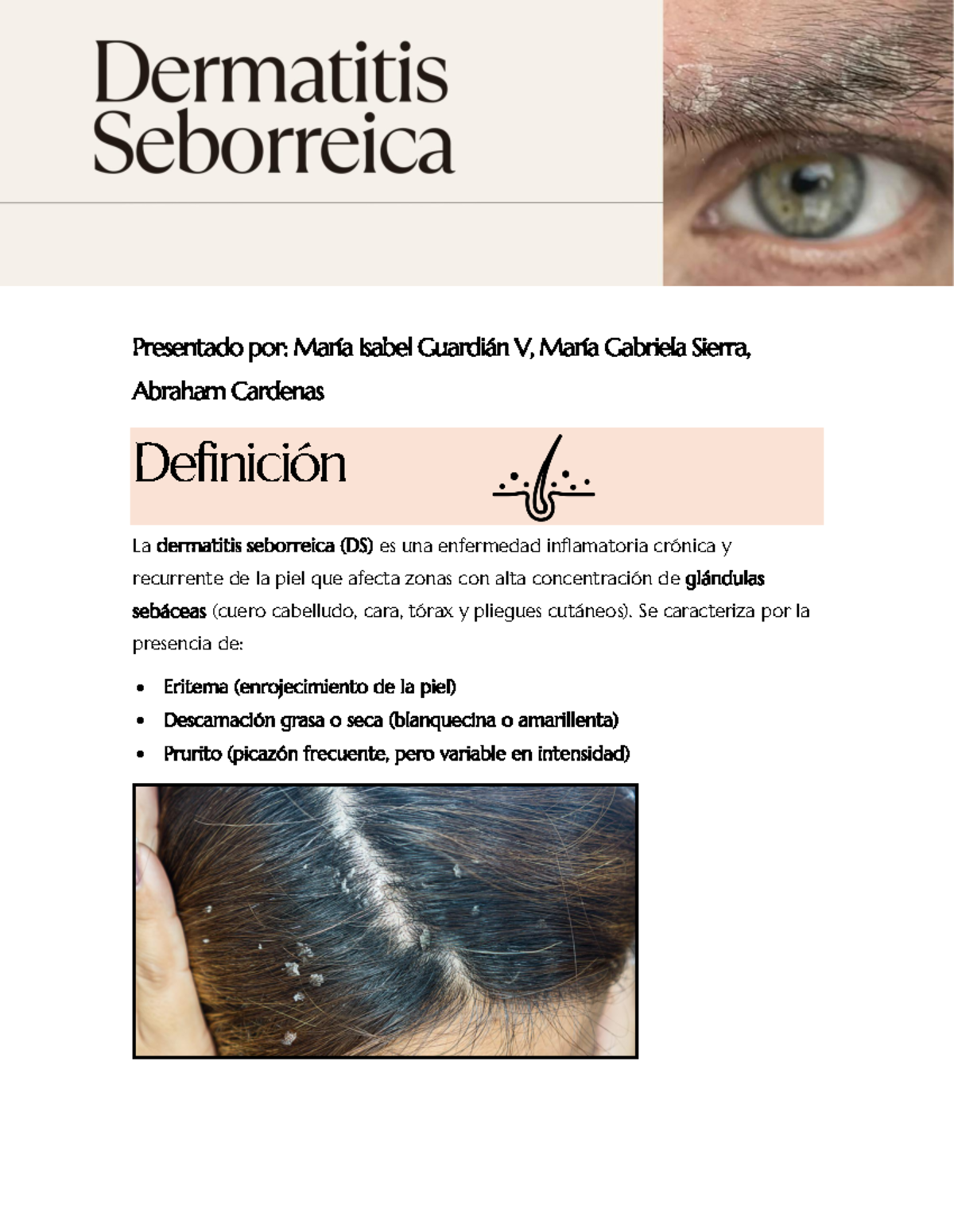 Dermatitis Seborreica - Se caracteriza por la presencia de: - Eritema ...