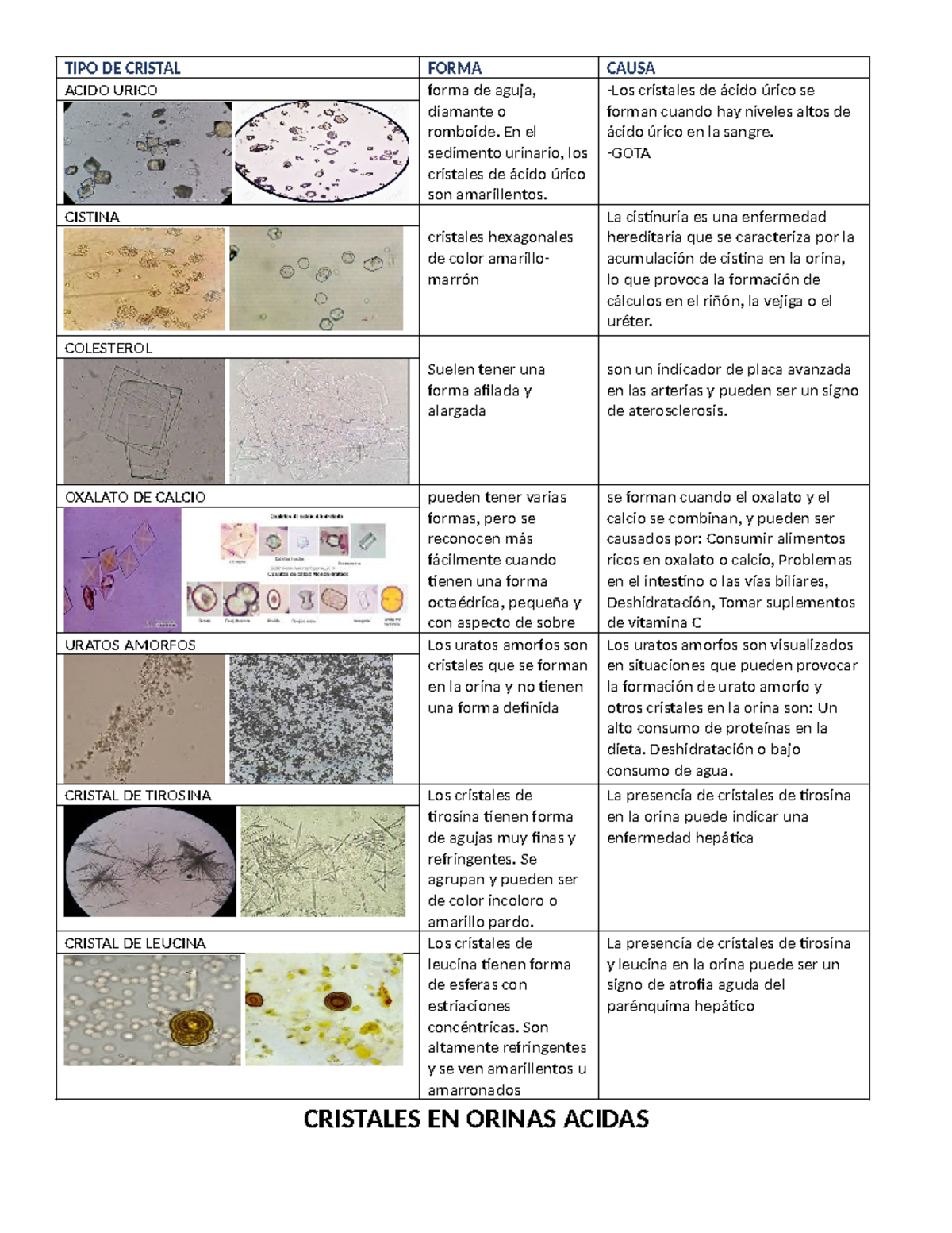 Cristales En Orina Tarea TIPO DE CRISTAL FORMA CAUSA ACIDO URICO 