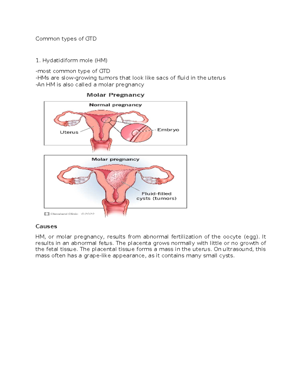 Common Types of Gestational Trophoblastic Disease (GTD) Explained - Studocu