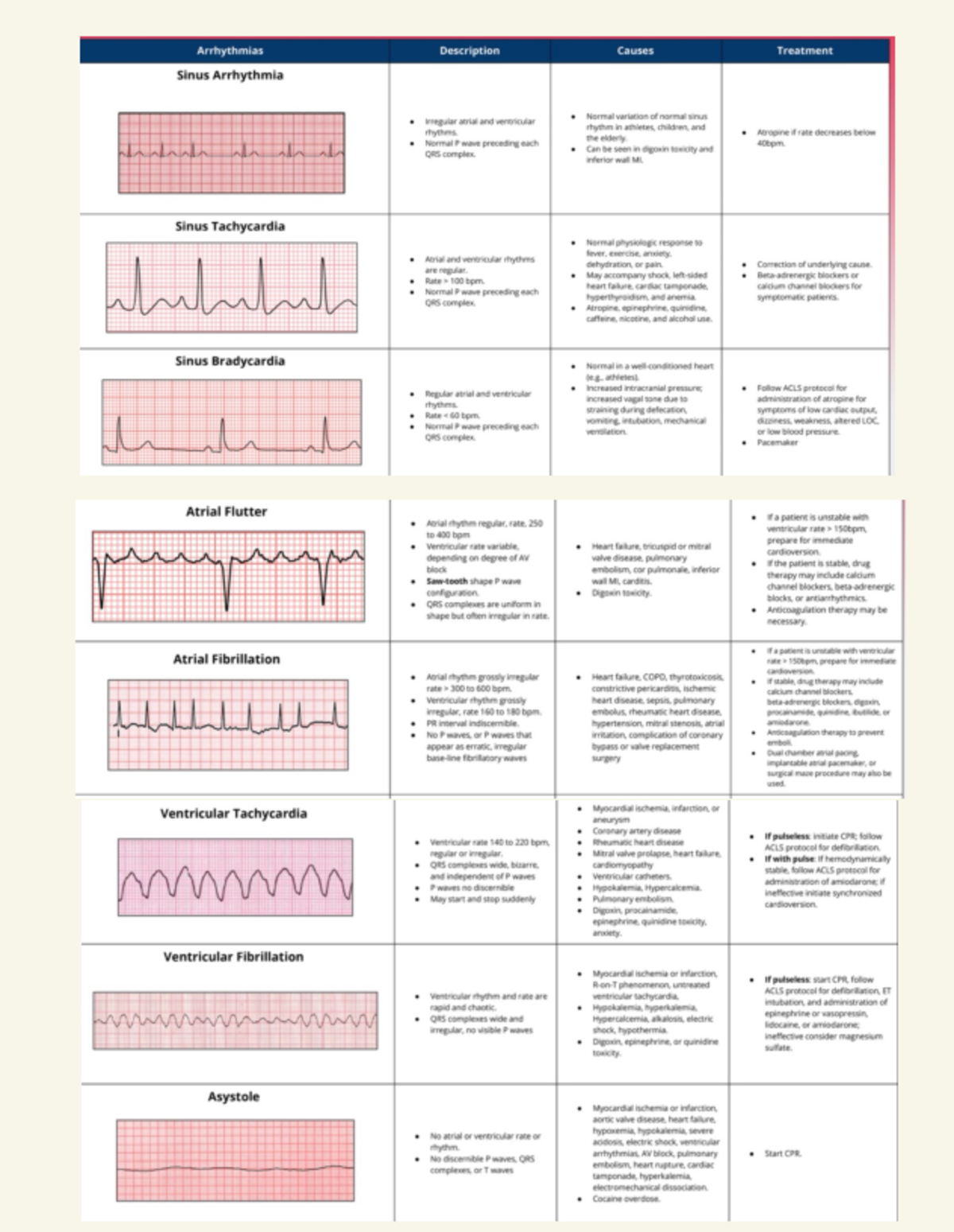 EKG Reference Images: Understanding Arrhythmias and Their