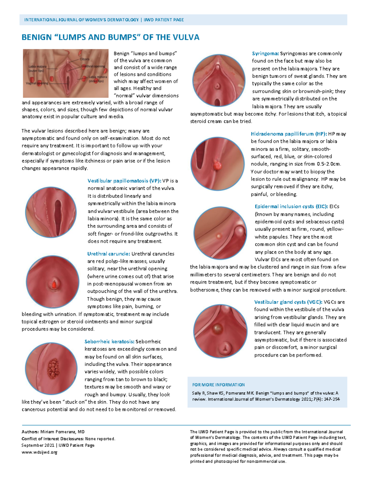 Benign “ Lumps AND Bumps” OF THE Vulva - Authors: Miriam Pomeranz, MD ...