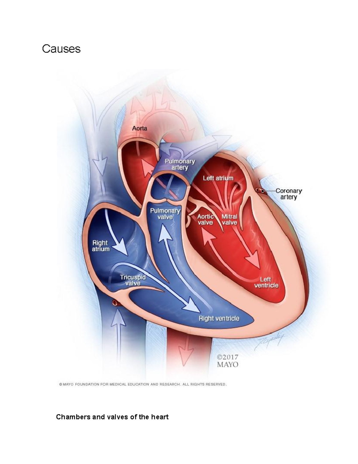 Causes of CHF: Understanding Congestive Heart Failure Factors - Studocu