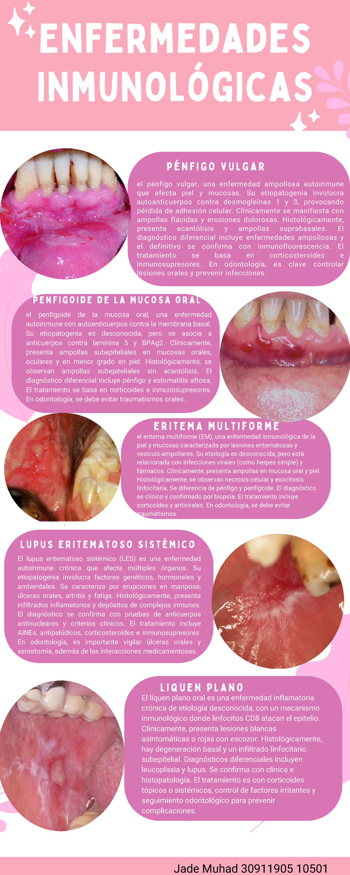 Grátis: Aula 5 e 6 -Lesoes Osseas, - Material Claro e Objetivo em PDF para  Estudo Rápido, image size:1200x3000