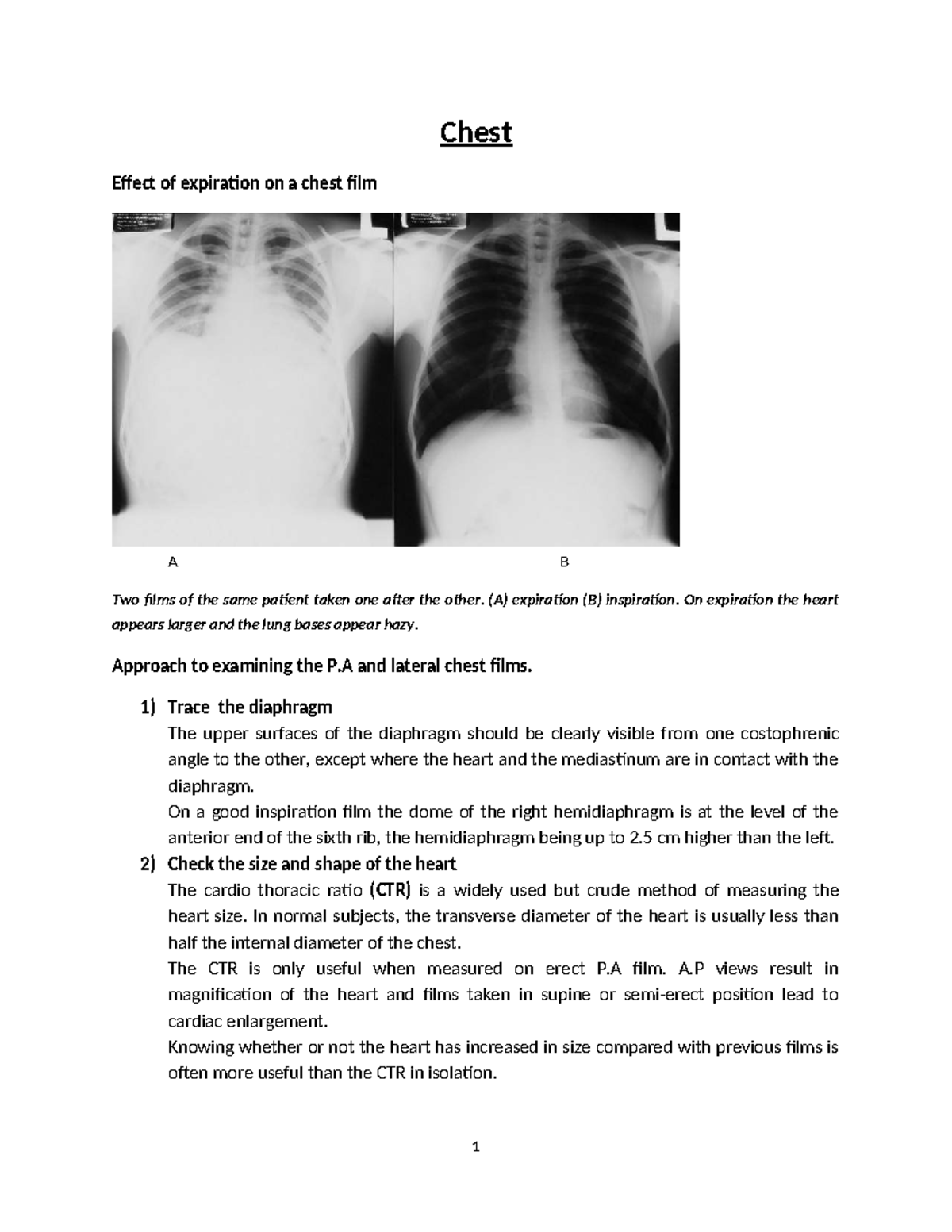 Chest Notes: Effects of Expiration on Radiographic Analysis - Studocu