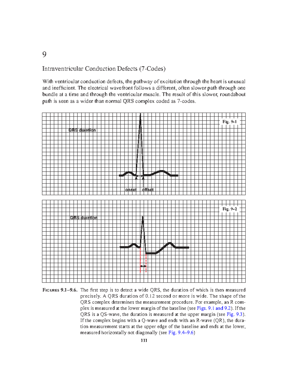 Intraventricular Conduction Defects: Understanding 7 Key Codes - Studocu