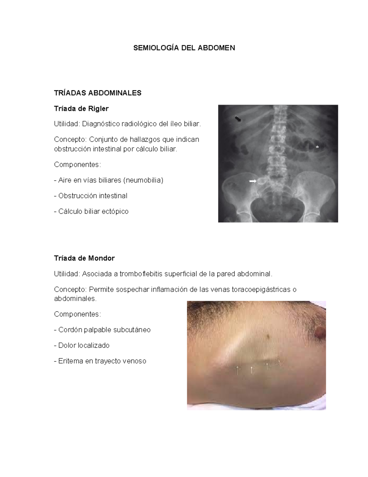 Semiología del Abdomen: Tríadas y Signos Clínicos Esenciales - Studocu