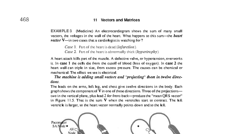 CH11 Vectors & Matrices: ECG Analysis of Heart Conditions - Studocu