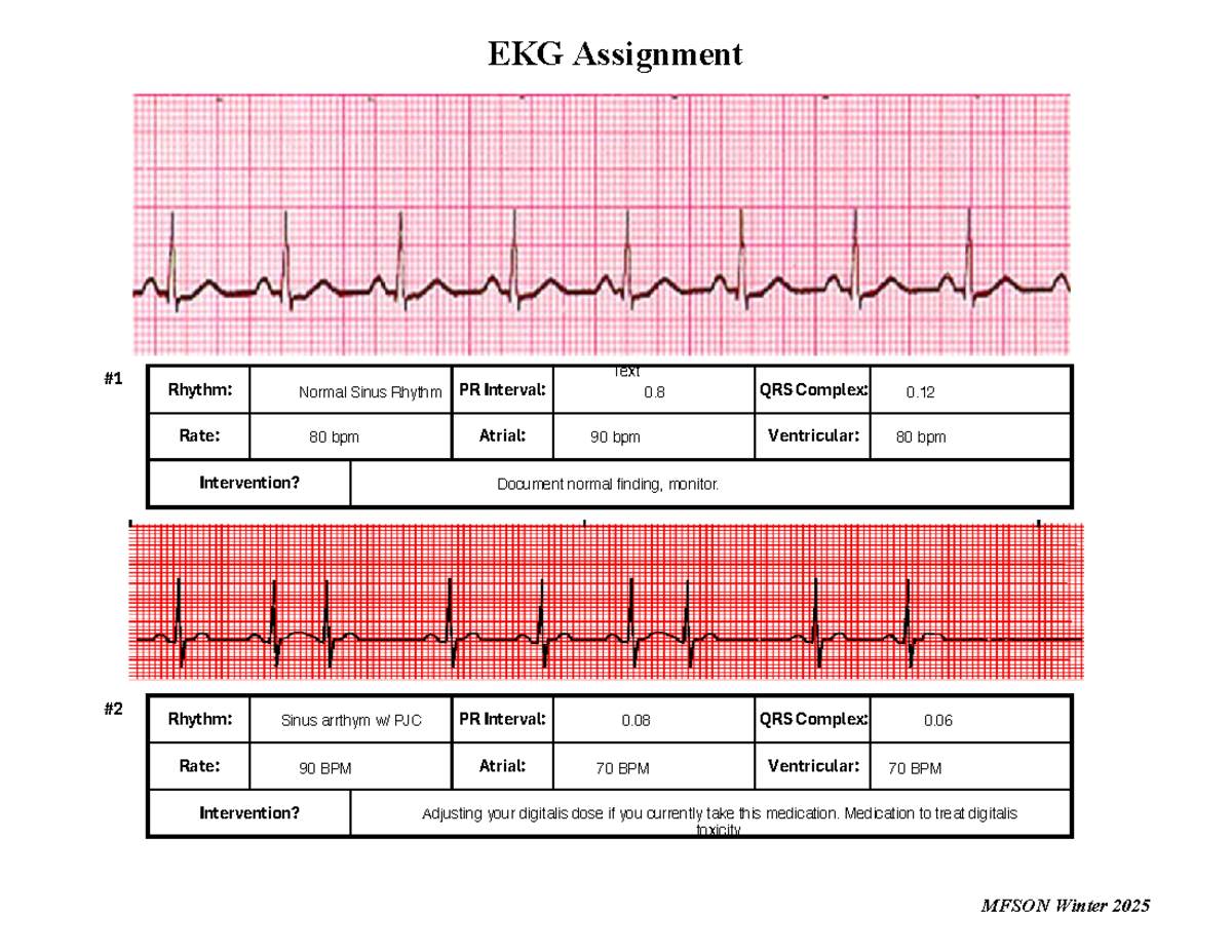 EKG Assignment-2 - helpful - Intervention? Rate: Atrial: Ventricular ...