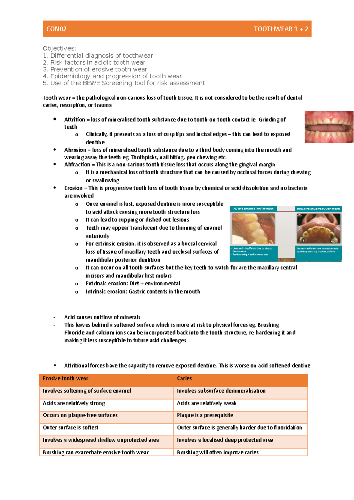 CON02 Tooth Wear Notes: Diagnosis, Risks, and Management Strategies ...