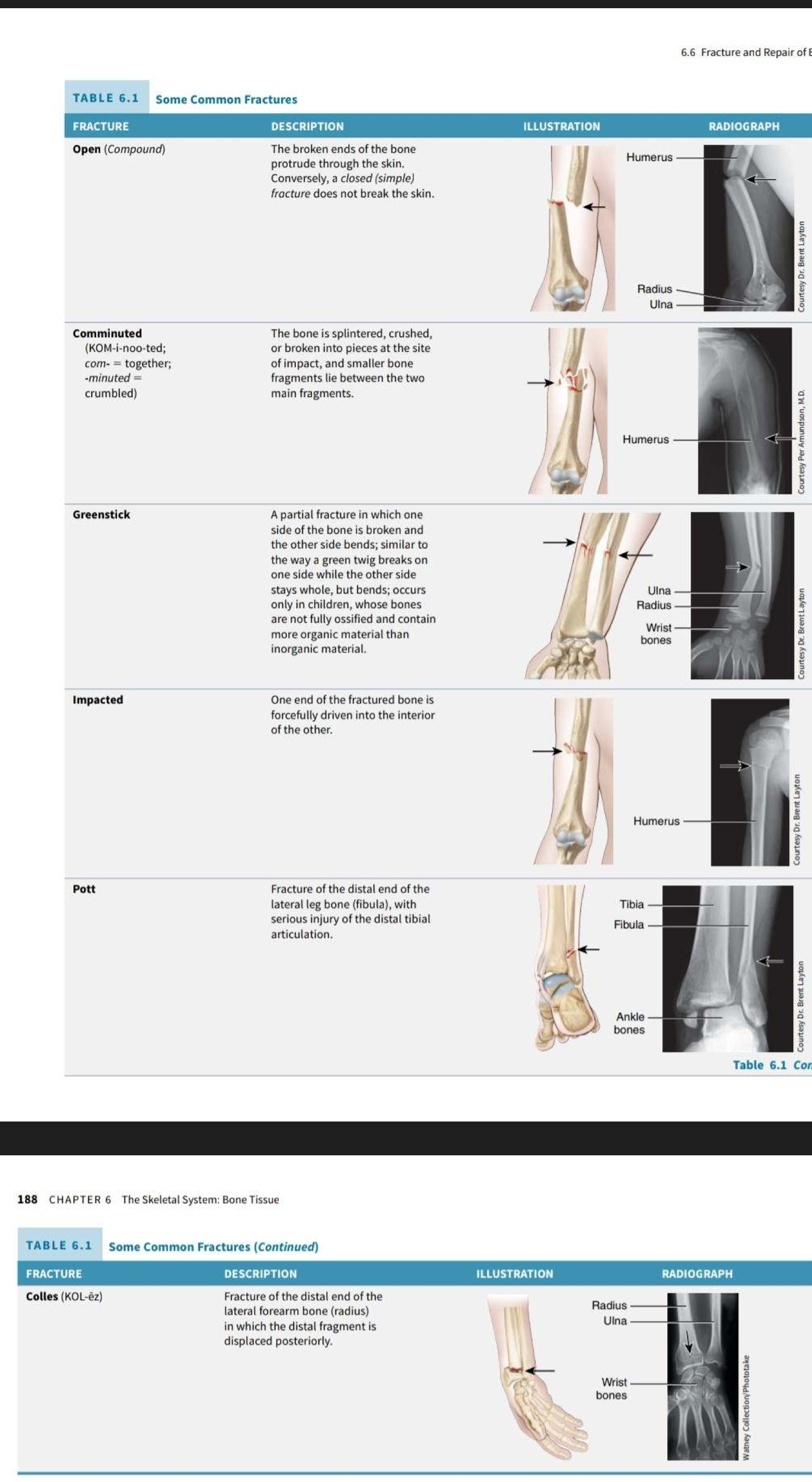 Types of Fractures - E 6.6: Common Fracture Descriptions and ...