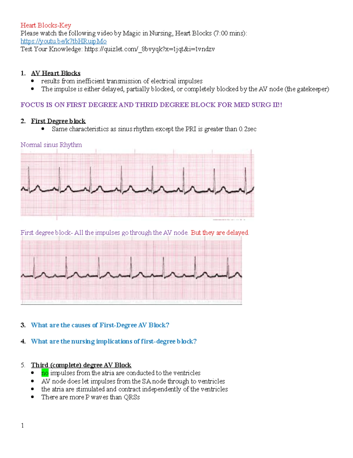 Med Surg II: Heart Blocks Overview and Key Concepts - Studocu