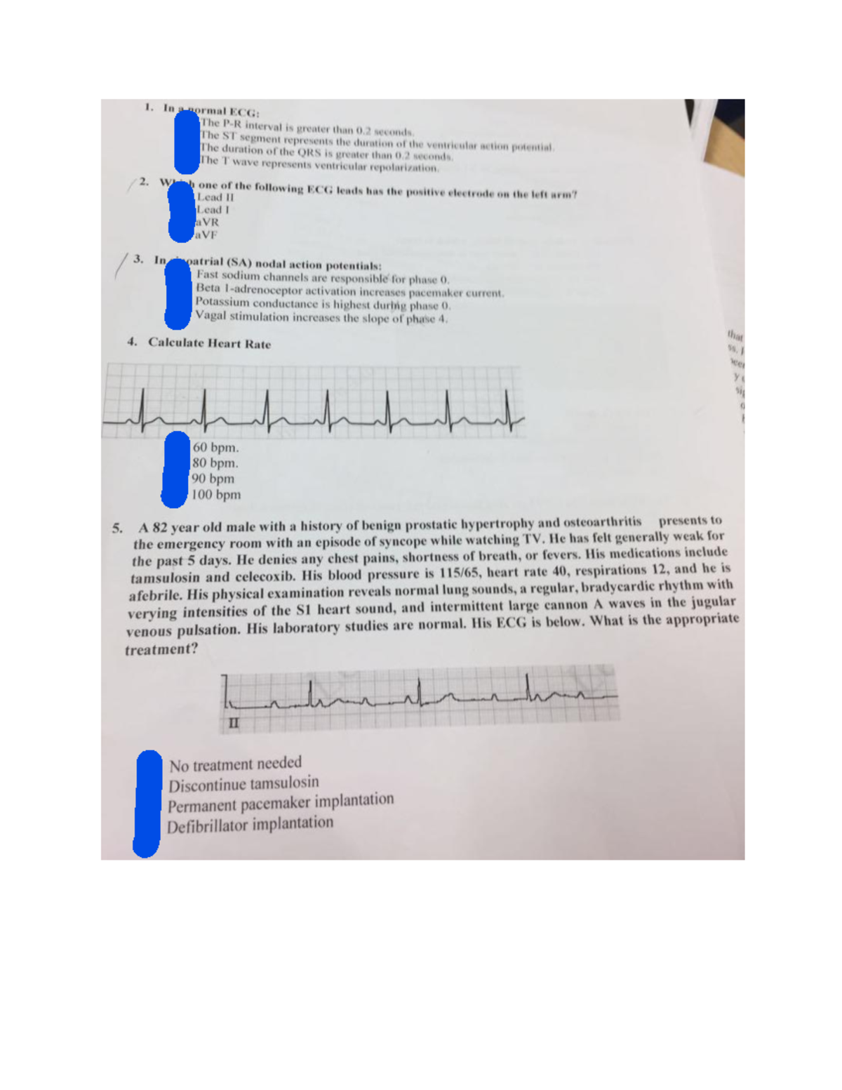 TBL 7 - ECG Interpretation and Clinical Case Summary - Studocu