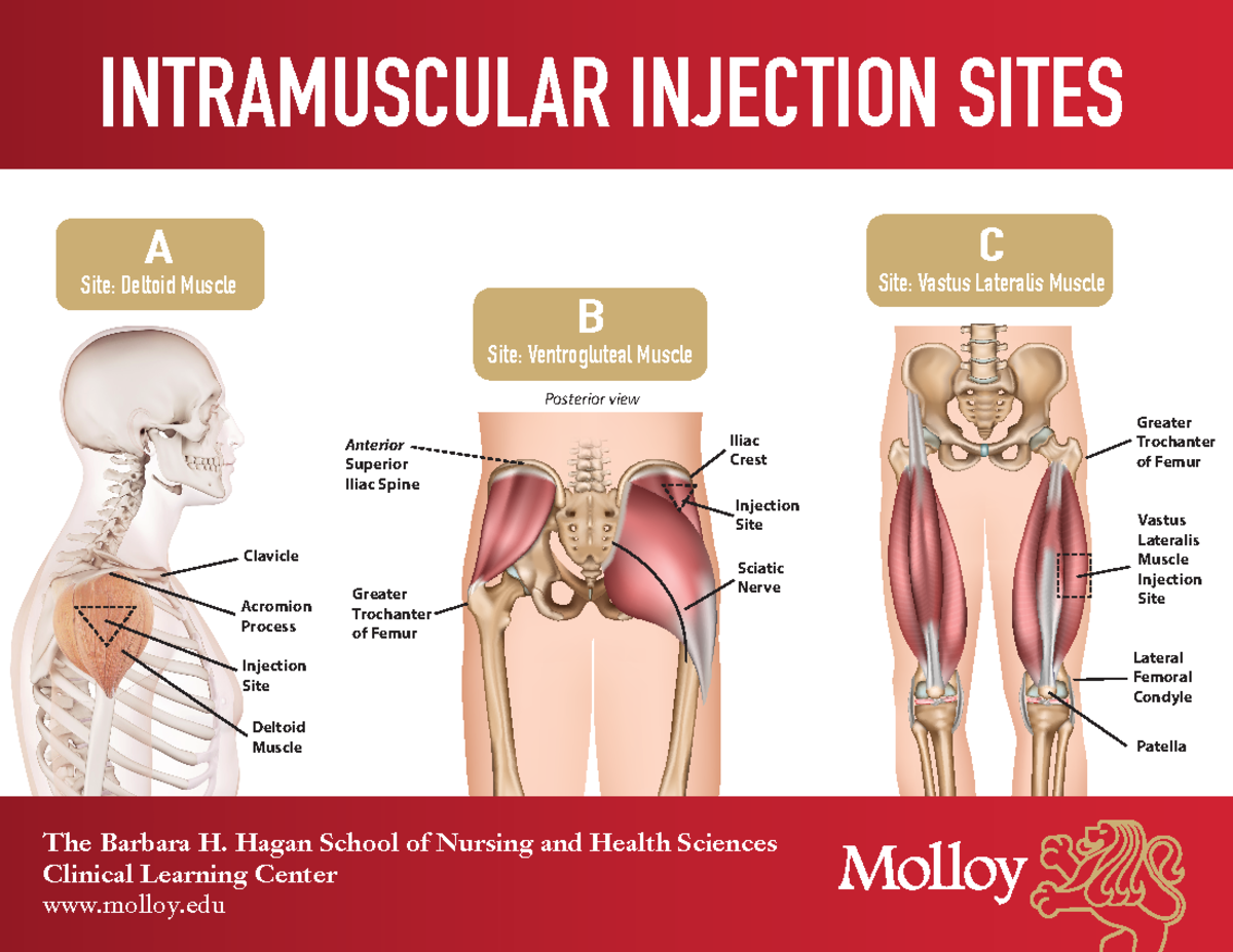 Intramuscular Injection Sites flyer ver2-2 - INTRAMUSCULAR INJECTION ...