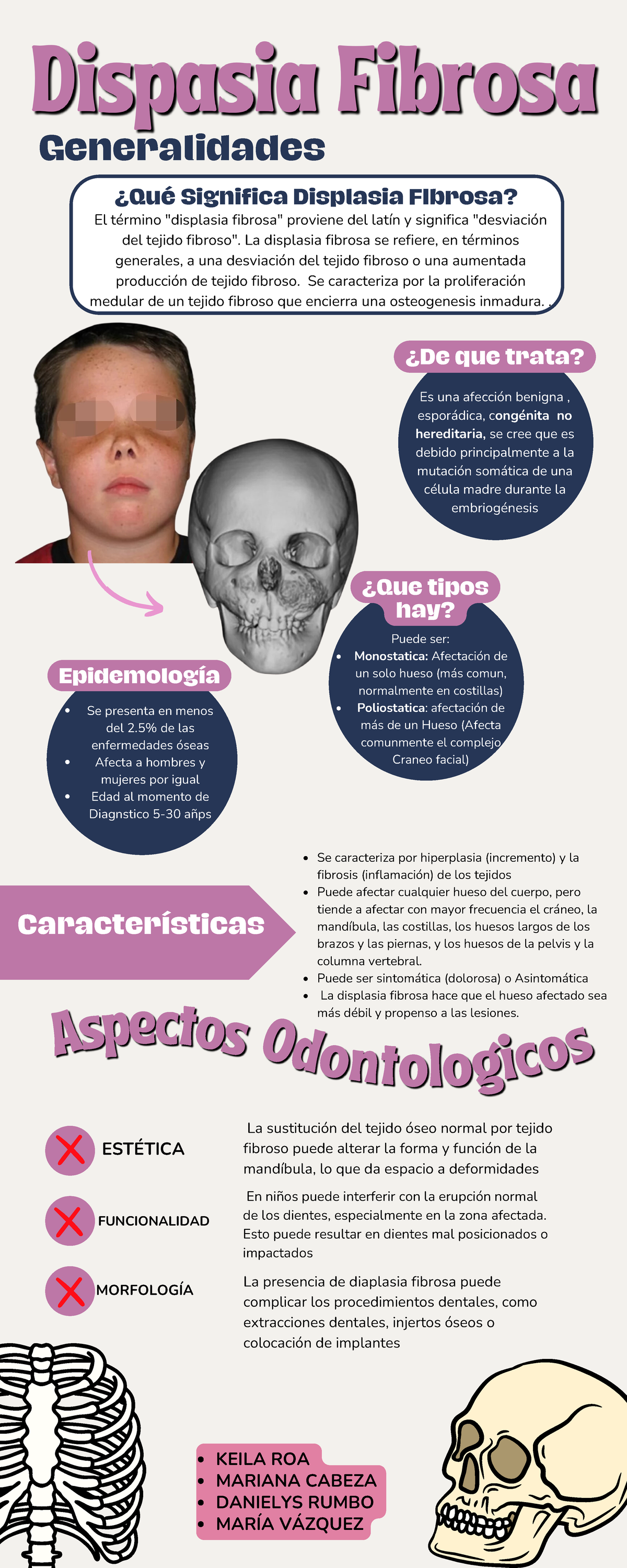Infografía sobre Displasia Fibrosa: Características y Tipos - Studocu