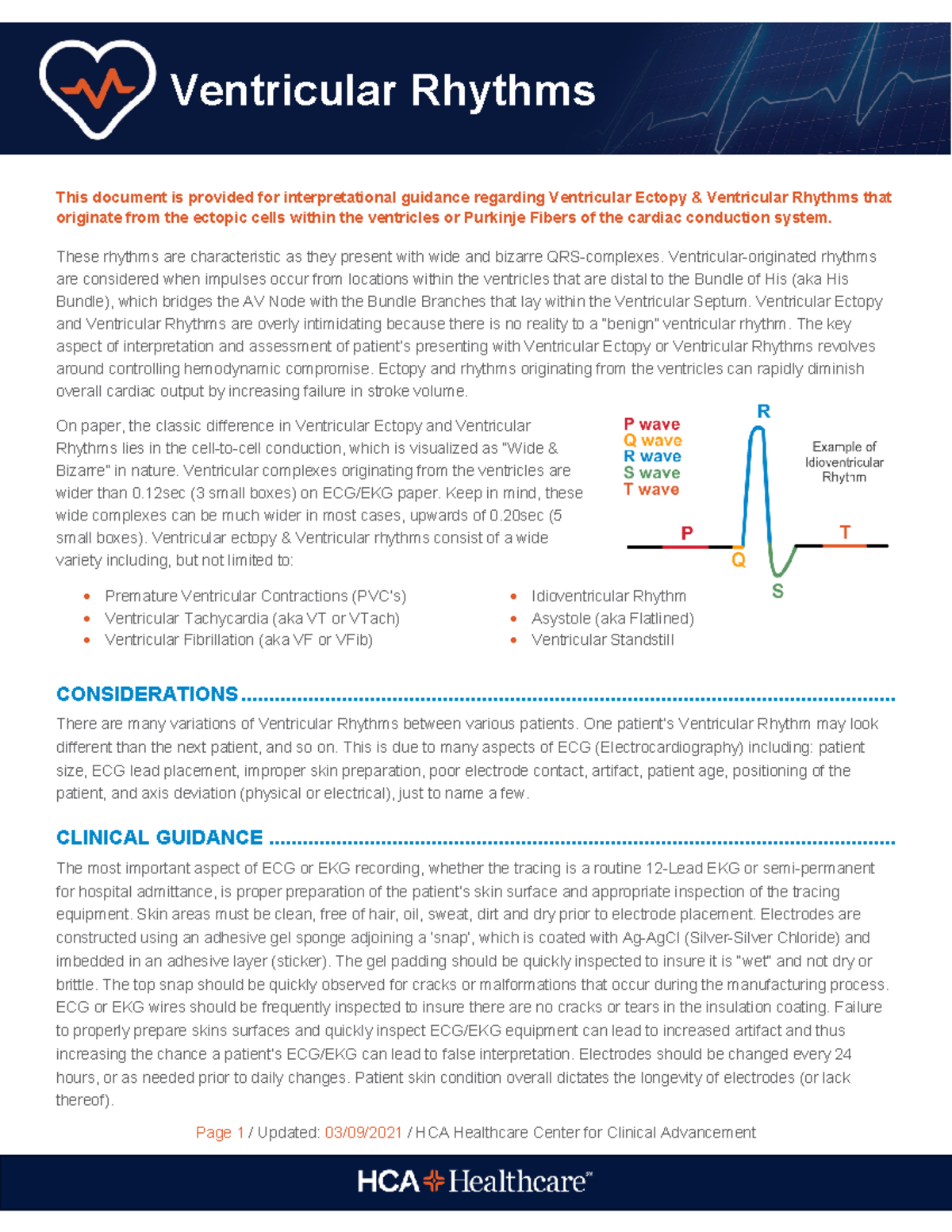 ECG Lethal Rhythms: A Guide on Ventricular Ectopy & Interpretation ...