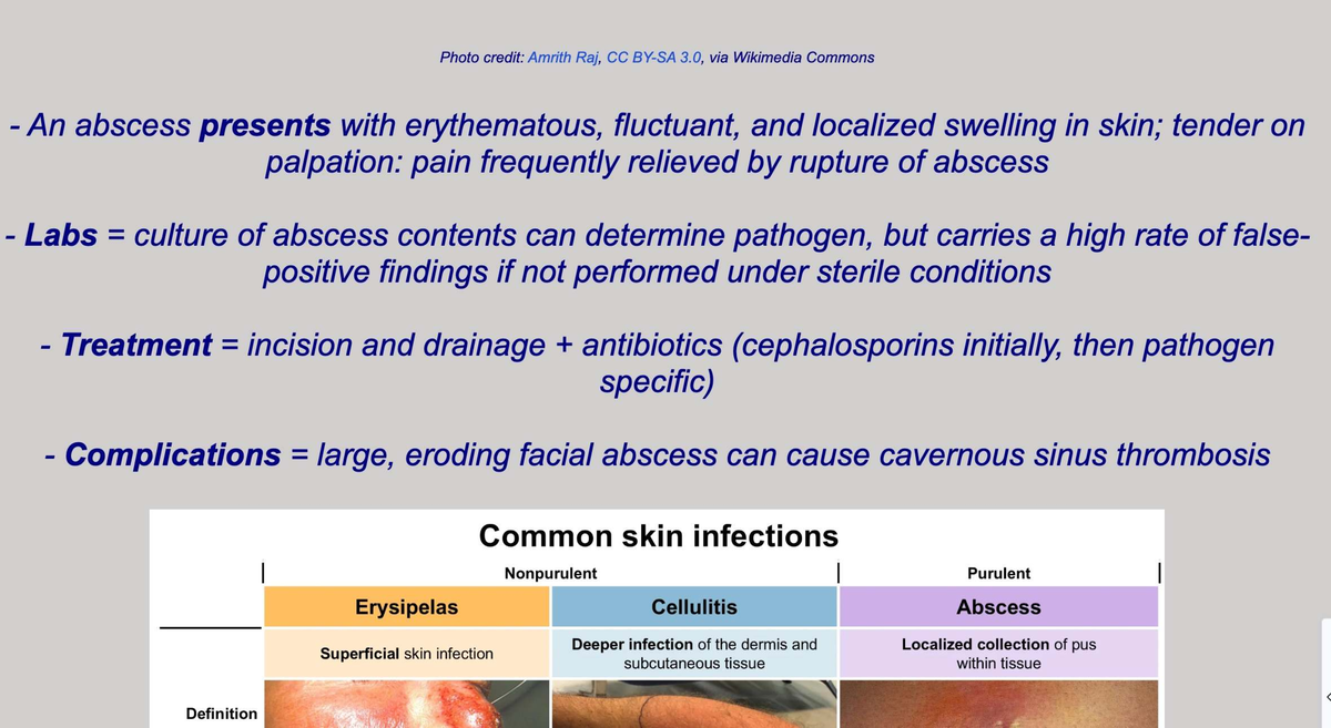 SKIN - BVDS: Understanding Abscesses and Common Skin Infections - Studocu