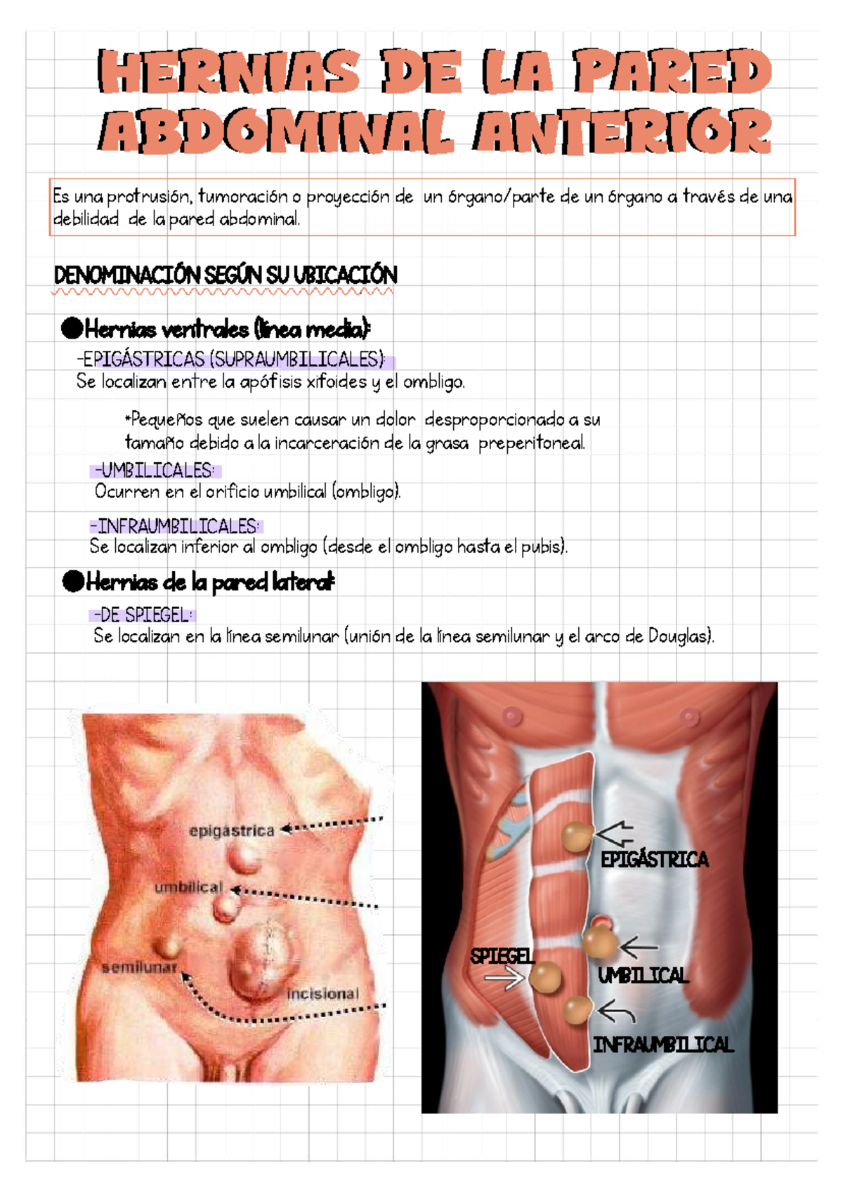 Hernias de la Pared Abdominal Anterior: Clasificación y Tratamiento ...