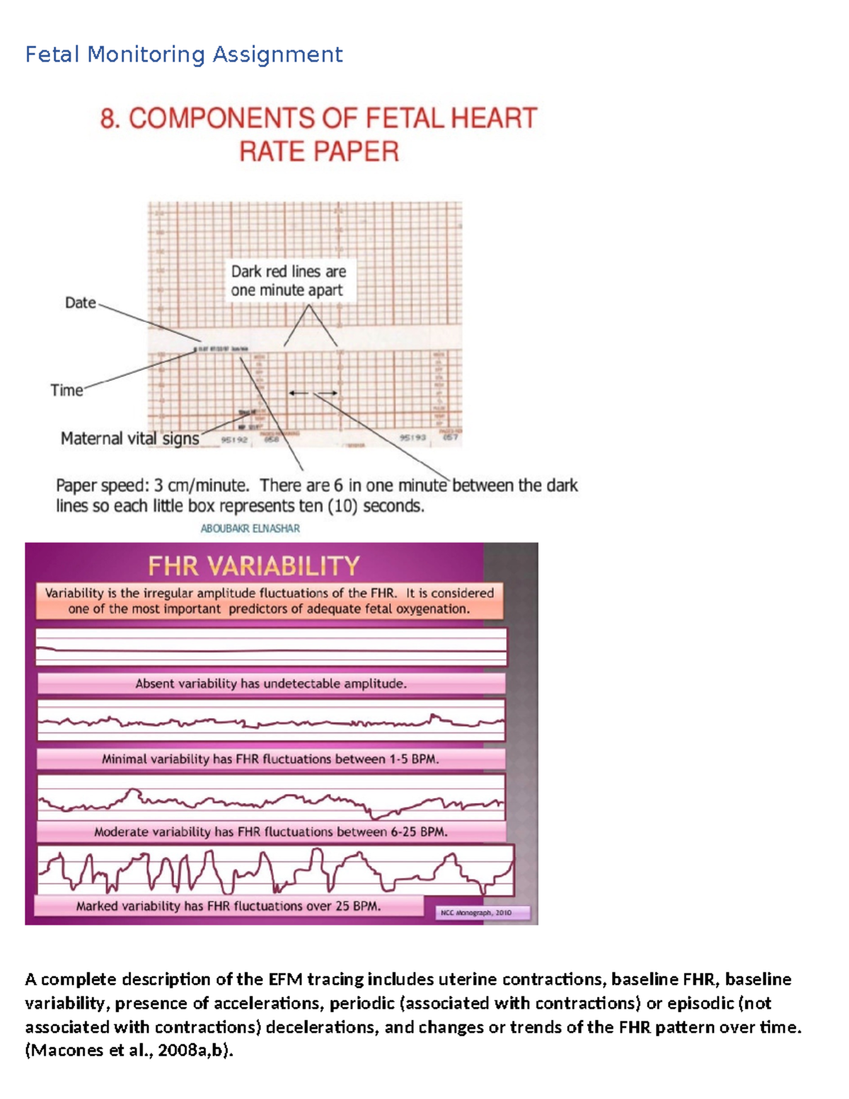 Fetal Monitoring Assignment: EFM Tracing Analysis - Studocu