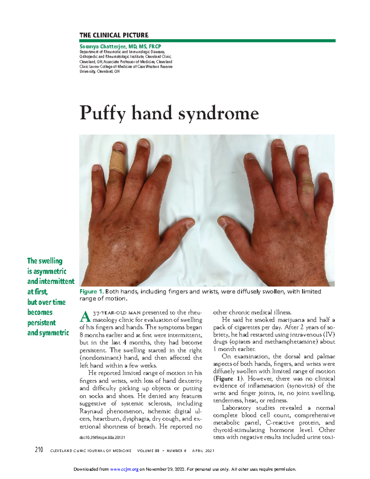 210 - Case Study on Puffy Hand Syndrome and IV Drug Use - Studocu