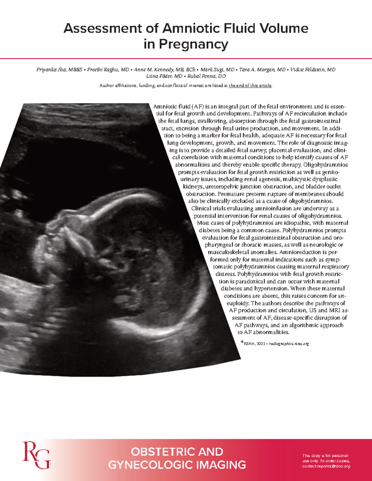 Assessment of Amniotic Fluid Volume in Pregnancy: RSNA 2023 Insights ...