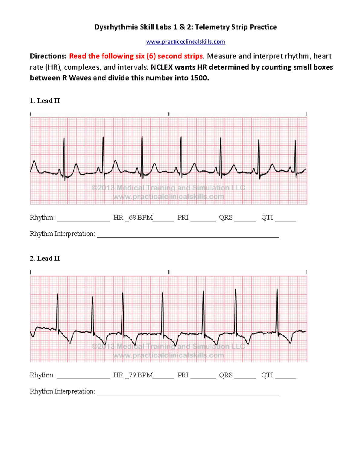 Dysrhythmia Skill Labs 1 & 2: Telemetry Strip Practice Notes - Studocu