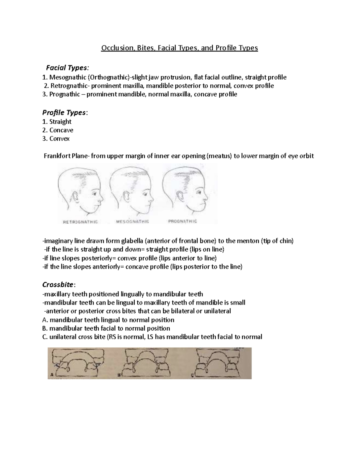 Occlusion - Retrognathic- prominent maxilla, mandible posterior to ...