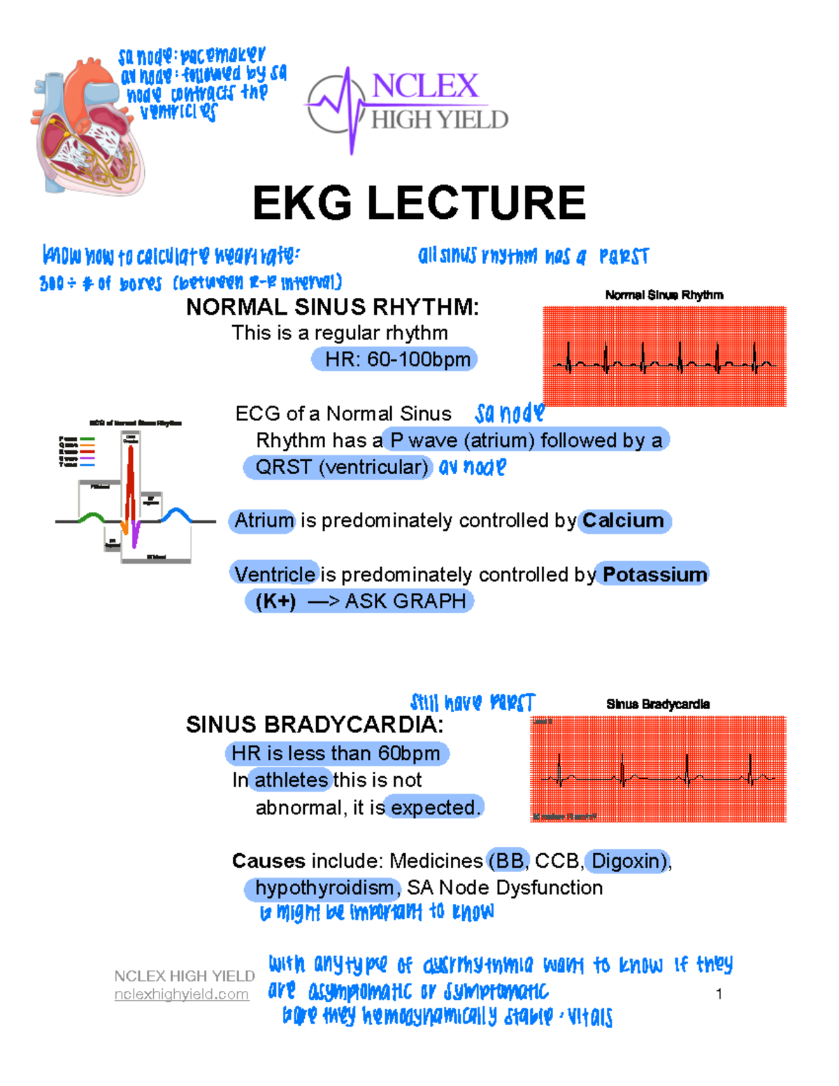 EKG Lecture Notes: Final Exam Study Guide (Feb 2023) - Studocu
