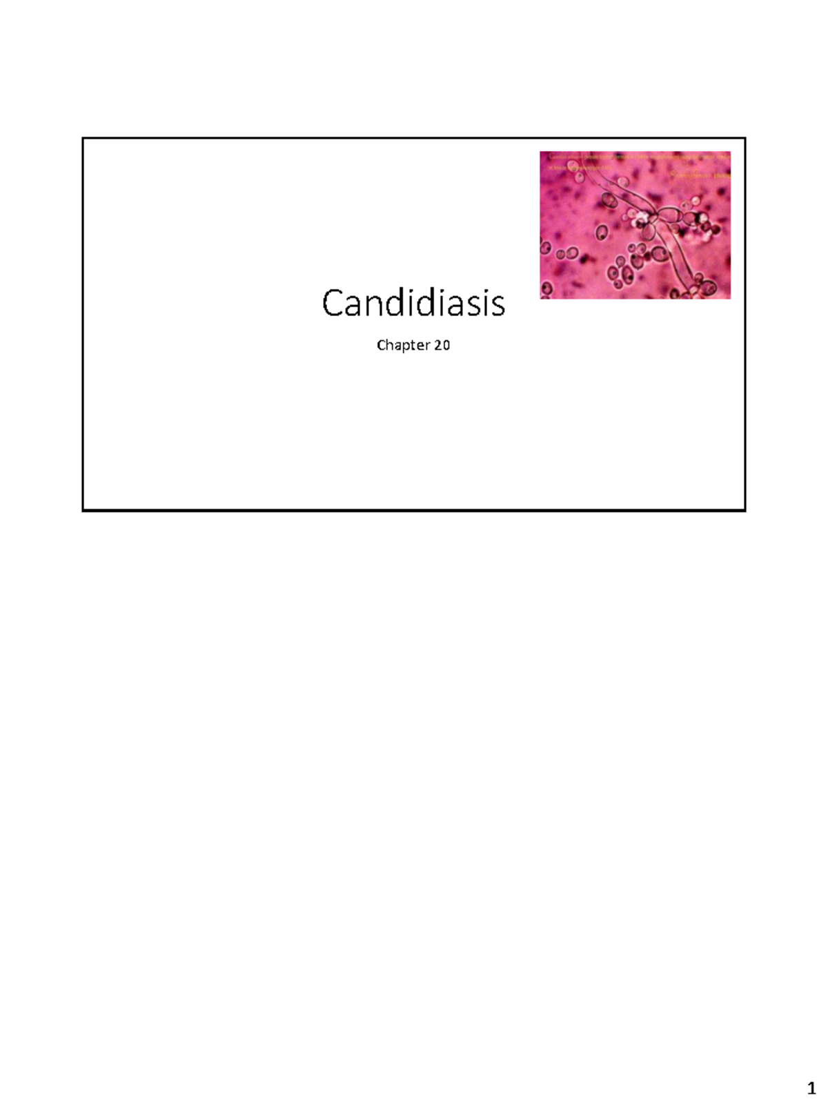 Chapter 20: Candidiasis - Understanding Opportunistic Mycoses - Studocu