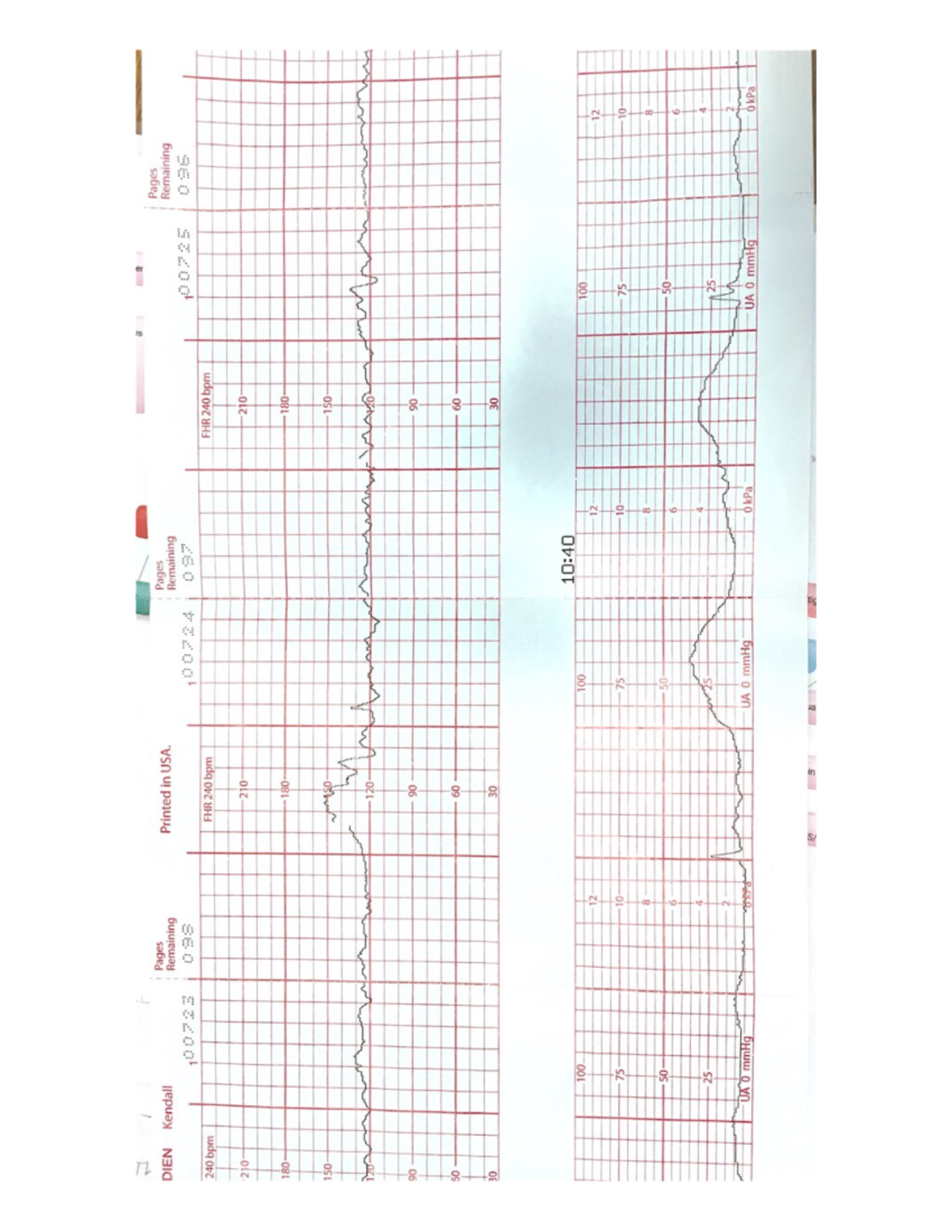 Week 4 - Fetal Monitoring Analysis and Data Overview - Studocu