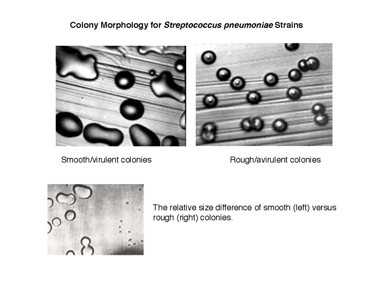 1 DNA structure and replication - Colony Morphology for Streptococcus ...