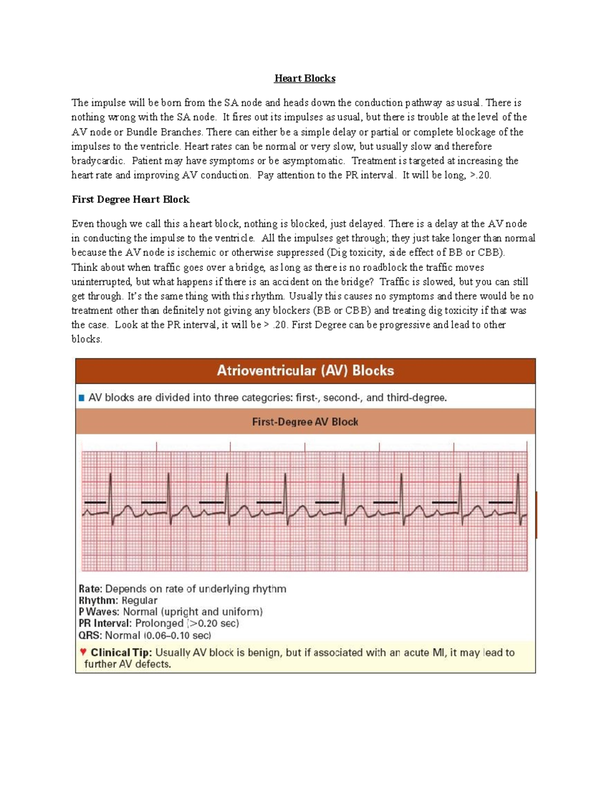 Heart Blocks Overview and Management Strategies (Cardiology 101) - Studocu