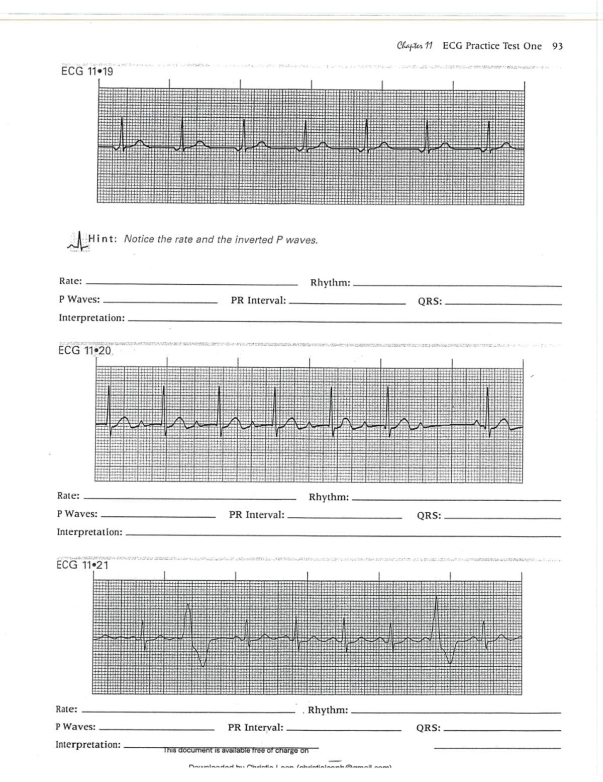 ECG 11 Practice Test: EKG Strips Analysis and Interpretation - Studocu