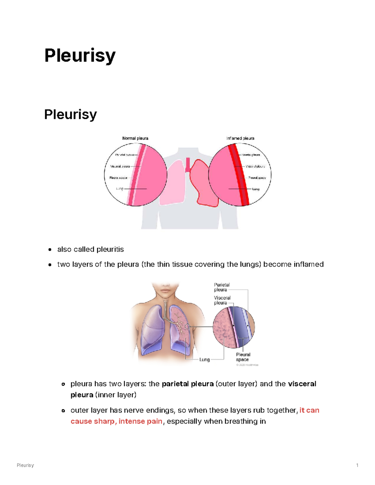 Pleurisy: Causes, Symptoms, and Management - A Comprehensive Guide ...