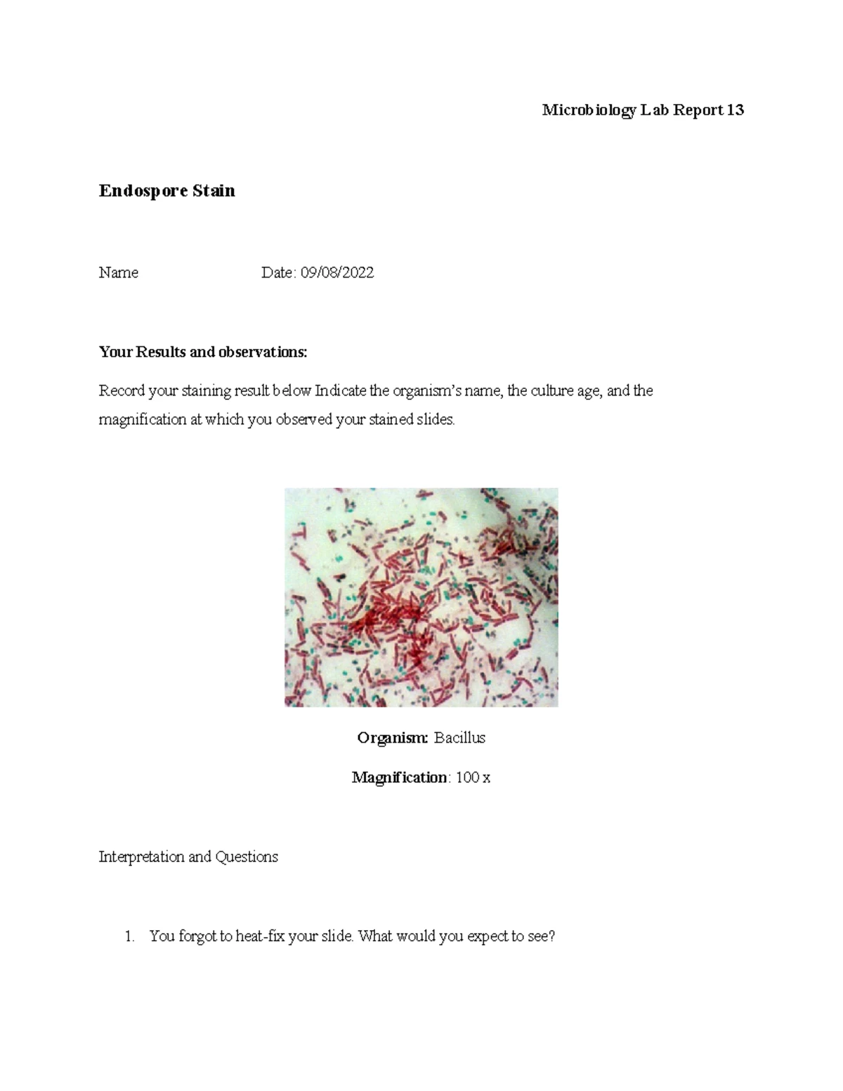 MICR Lab Wk 2,3 (1) - micrbiology lab report - MICRO 290 - Studocu