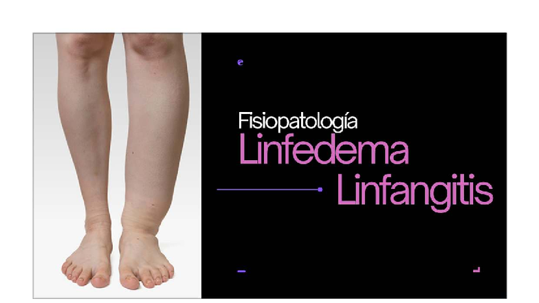 Fisiopatología del Linfedema y Linfangitis - FISIOPATOLOGIA - Studocu