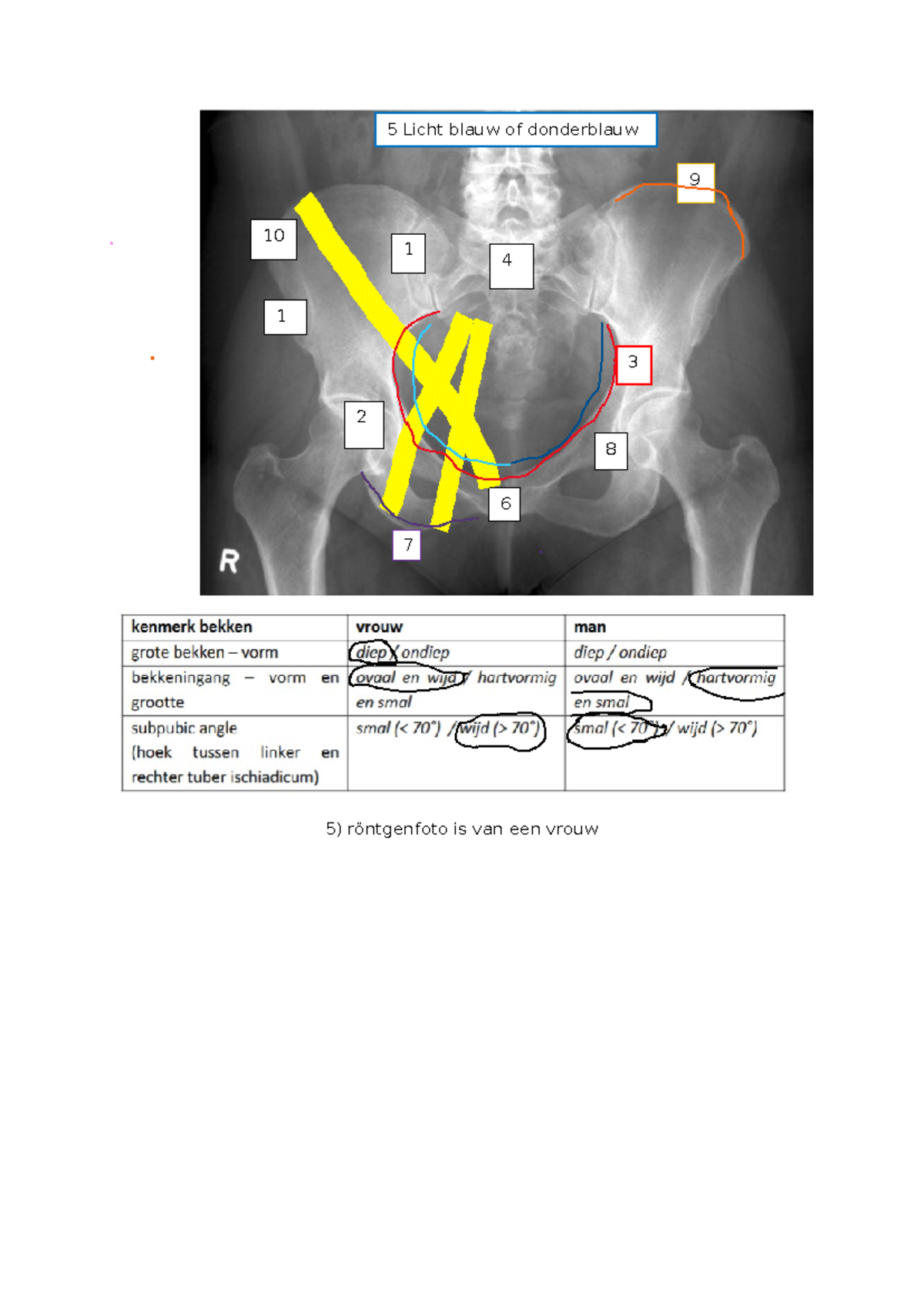 Anatomie van het Bekken: Essentiële Informatie en Anatomische ...