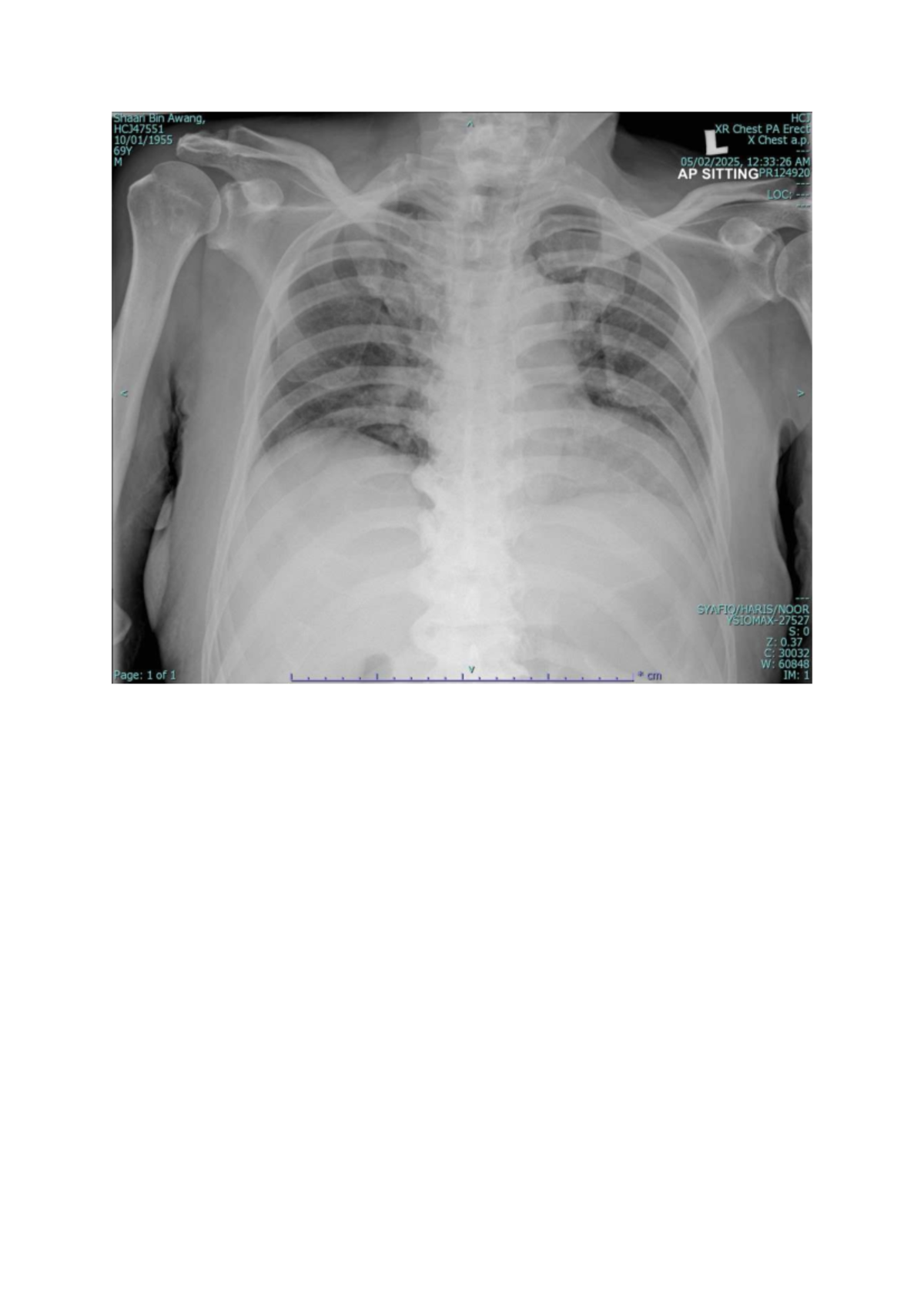 AP Chest Radiograph Evaluation Using PACEMAN Method Analysis - Studocu