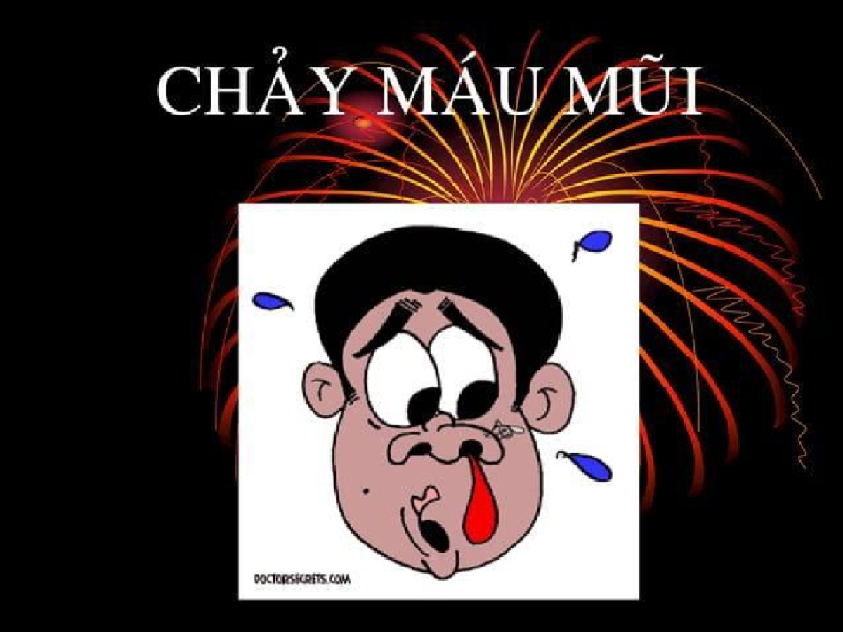 Chảy Máu Mũi: Nguyên Nhân và Phương Pháp Điều Trị (CHA Y MAU MUI) - Studocu