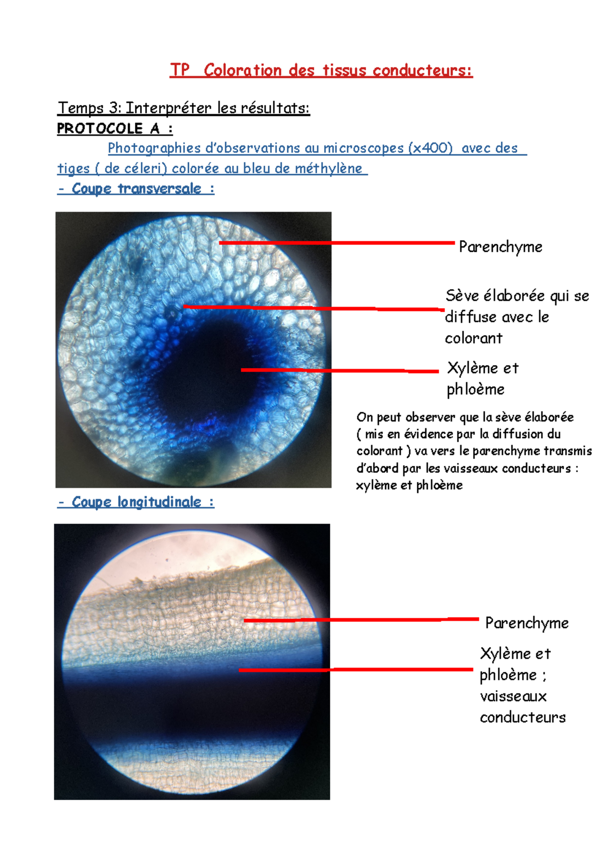 TP sur la Coloration des Tissus Conducteurs de Céleri (TP Biologie ...